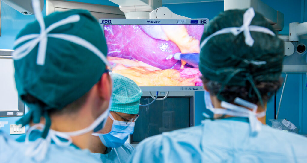 Chirurgia mininvasiva — la visione laparoscopica sul monitor